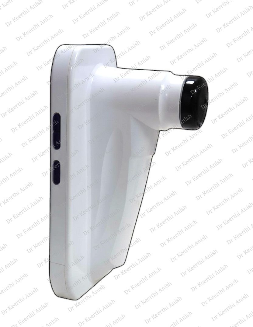 Handheld Autorefractor